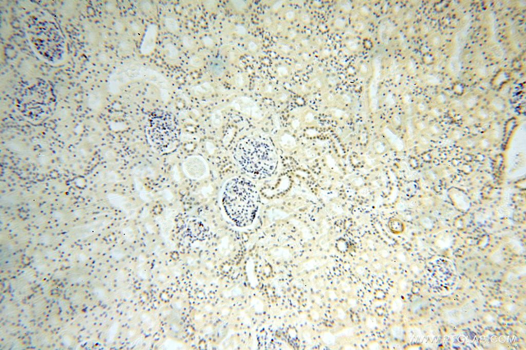 Immunohistochemistry (IHC) staining of human kidney tissue using CDKN2AIP Polyclonal antibody (16615-1-AP)