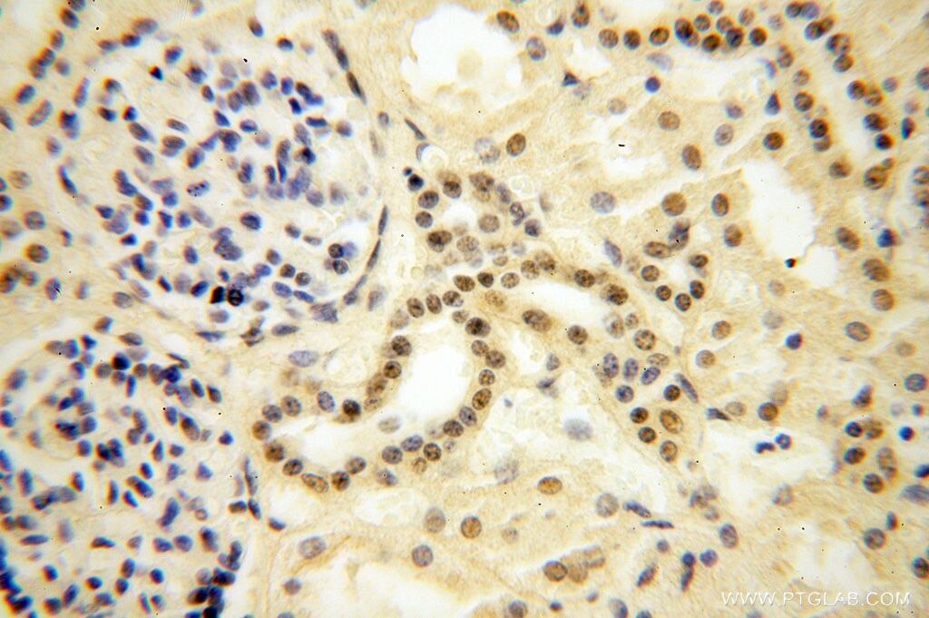 Immunohistochemistry (IHC) staining of human kidney tissue using CDKN2AIP Polyclonal antibody (16615-1-AP)