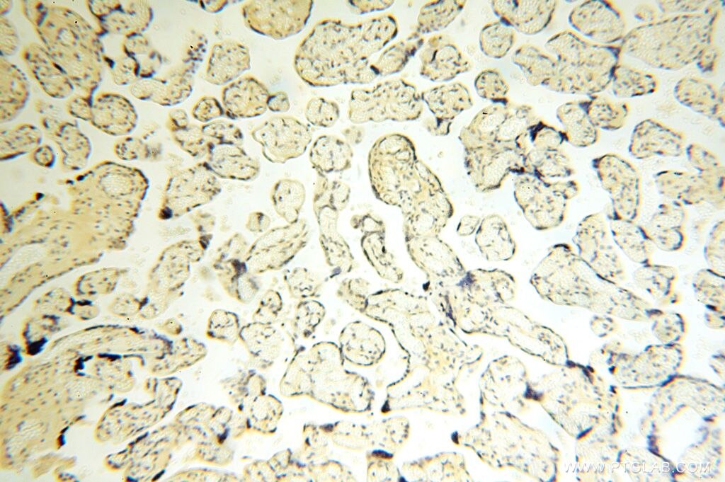 Immunohistochemistry (IHC) staining of human placenta tissue using CDKN2AIP Polyclonal antibody (16615-1-AP)