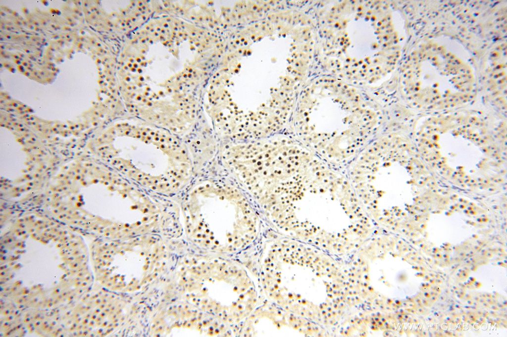 Immunohistochemistry (IHC) staining of human testis tissue using CDKN2AIP Polyclonal antibody (16615-1-AP)