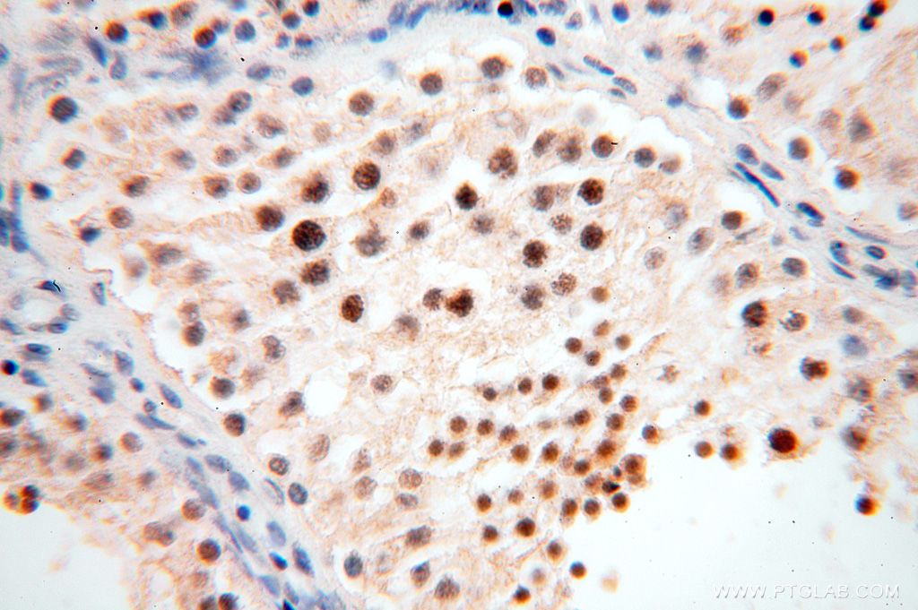 Immunohistochemistry (IHC) staining of human testis tissue using CDKN2AIP Polyclonal antibody (16615-1-AP)