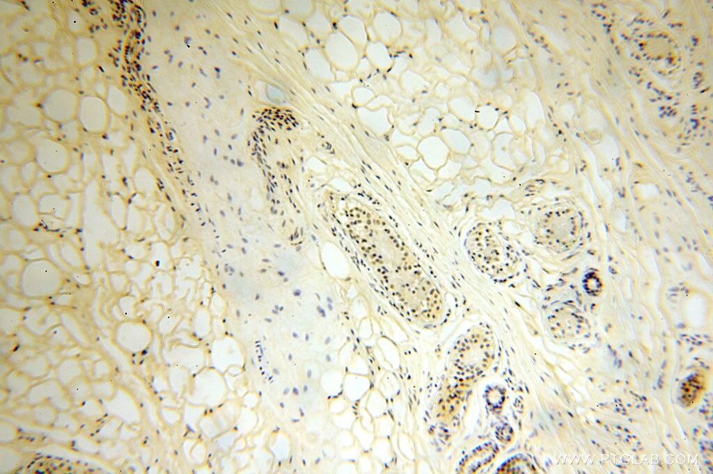 Immunohistochemistry (IHC) staining of human skin tissue using CDKN2AIP Polyclonal antibody (16615-1-AP)