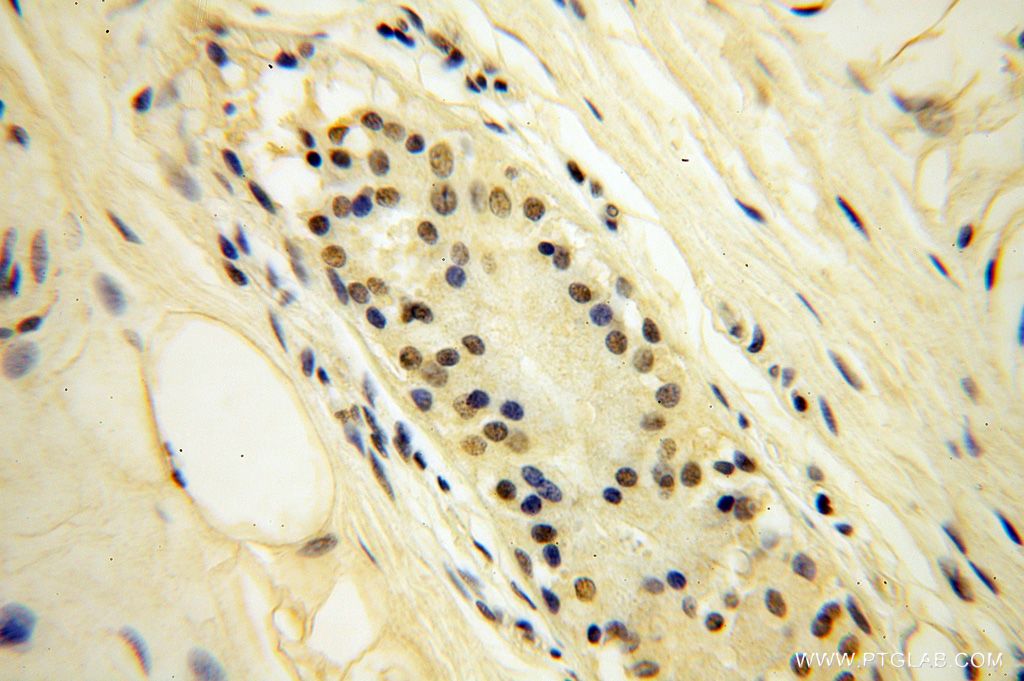 Immunohistochemistry (IHC) staining of human skin tissue using CDKN2AIP Polyclonal antibody (16615-1-AP)