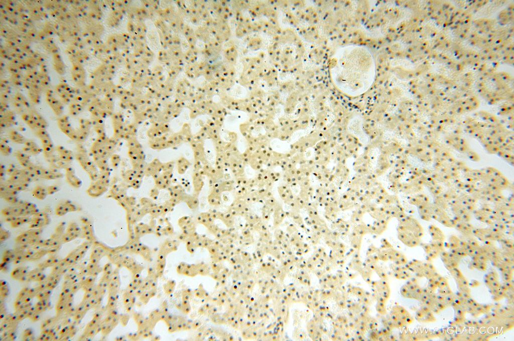 Immunohistochemistry (IHC) staining of human liver tissue using CDKN2AIP Polyclonal antibody (16615-1-AP)