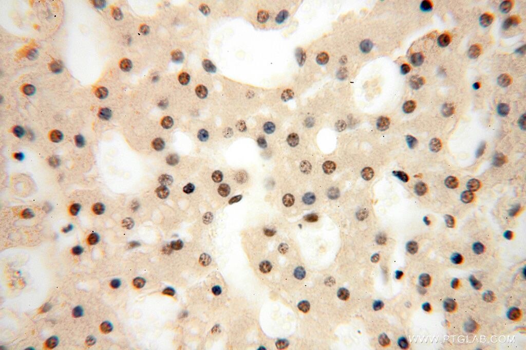 Immunohistochemistry (IHC) staining of human liver tissue using CDKN2AIP Polyclonal antibody (16615-1-AP)