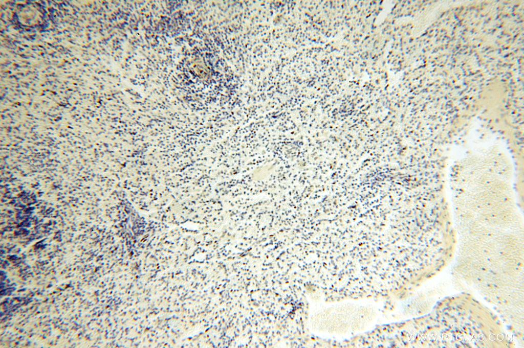 Immunohistochemistry (IHC) staining of human spleen tissue using CDKN2AIP Polyclonal antibody (16615-1-AP)