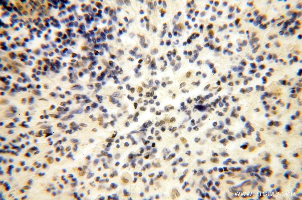 Immunohistochemistry (IHC) staining of human spleen tissue using CDKN2AIP Polyclonal antibody (16615-1-AP)