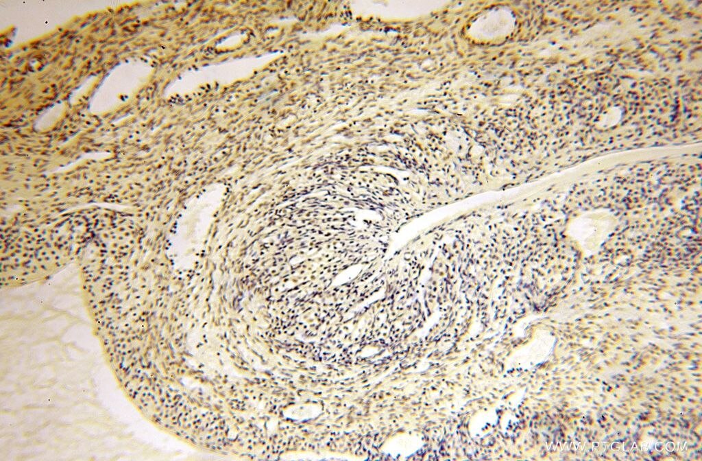 Immunohistochemistry (IHC) staining of human ovary tissue using CDKN2AIP Polyclonal antibody (16615-1-AP)