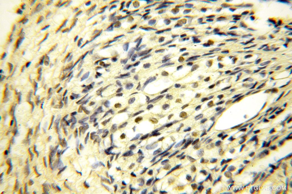 IHC staining of human ovary using 16615-1-AP