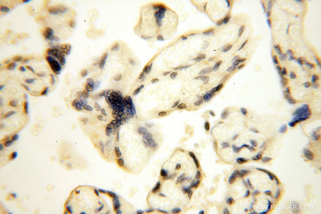 Immunohistochemistry (IHC) staining of human placenta tissue using CDKN2AIP Polyclonal antibody (16615-1-AP)