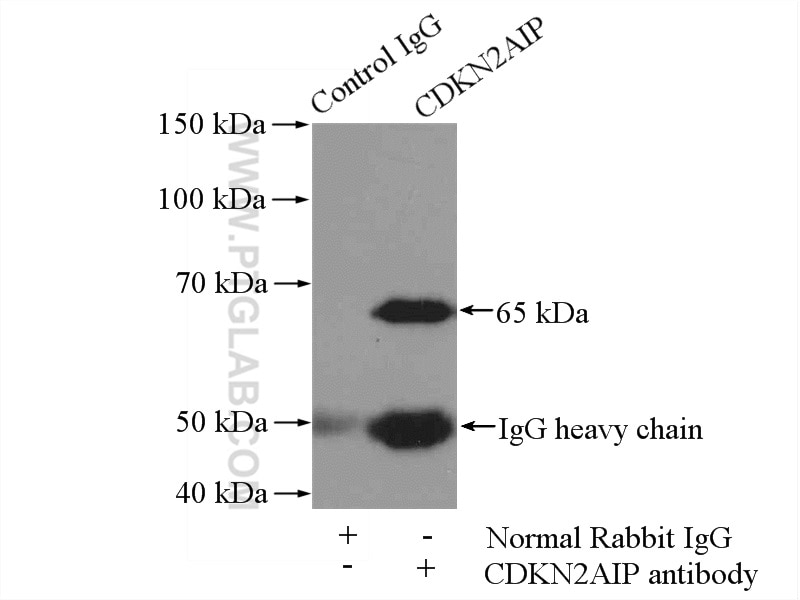 Immunoprecipitation (IP) experiment of HeLa cells using CDKN2AIP Polyclonal antibody (16615-1-AP)