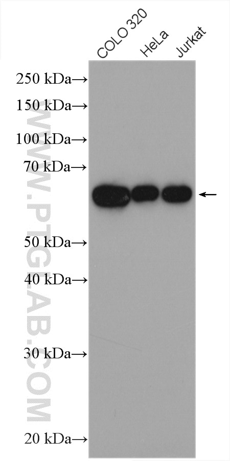 Western Blot (WB) analysis of various lysates using CDKN2AIP Polyclonal antibody (16615-1-AP)