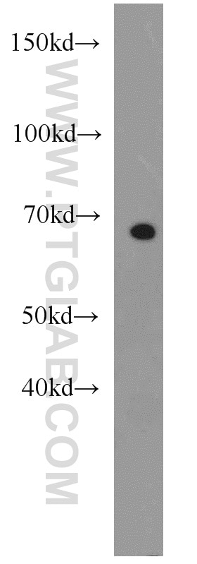 Western Blot (WB) analysis of Jurkat cells using CDKN2AIP Polyclonal antibody (16615-1-AP)