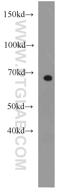 WB analysis of Jurkat using 16615-1-AP