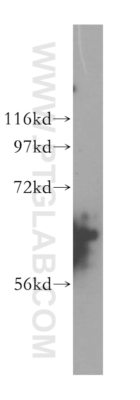 Western Blot (WB) analysis of HeLa cells using CDKN2AIP Polyclonal antibody (16615-1-AP)