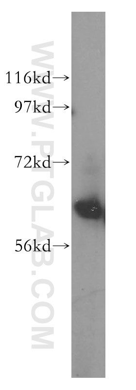 Western Blot (WB) analysis of Jurkat cells using CDKN2AIP Polyclonal antibody (16615-1-AP)