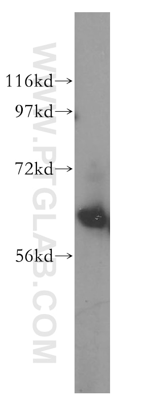 WB analysis of Jurkat using 16615-1-AP