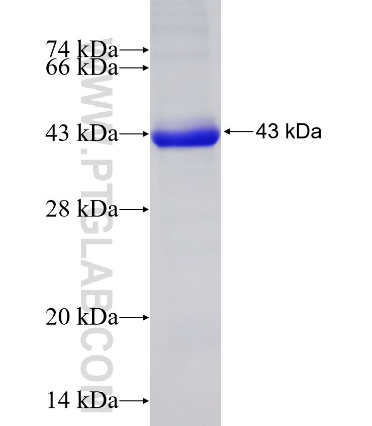 CDKN2AIP fusion protein Ag9825 SDS-PAGE