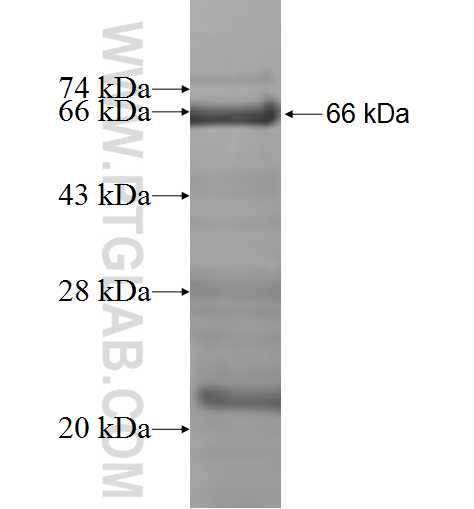 CDKN2AIP fusion protein Ag9907 SDS-PAGE