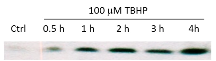 p15 INK4b Polyclonal antibody