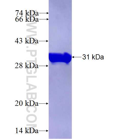 CDKN2B fusion protein Ag26955 SDS-PAGE