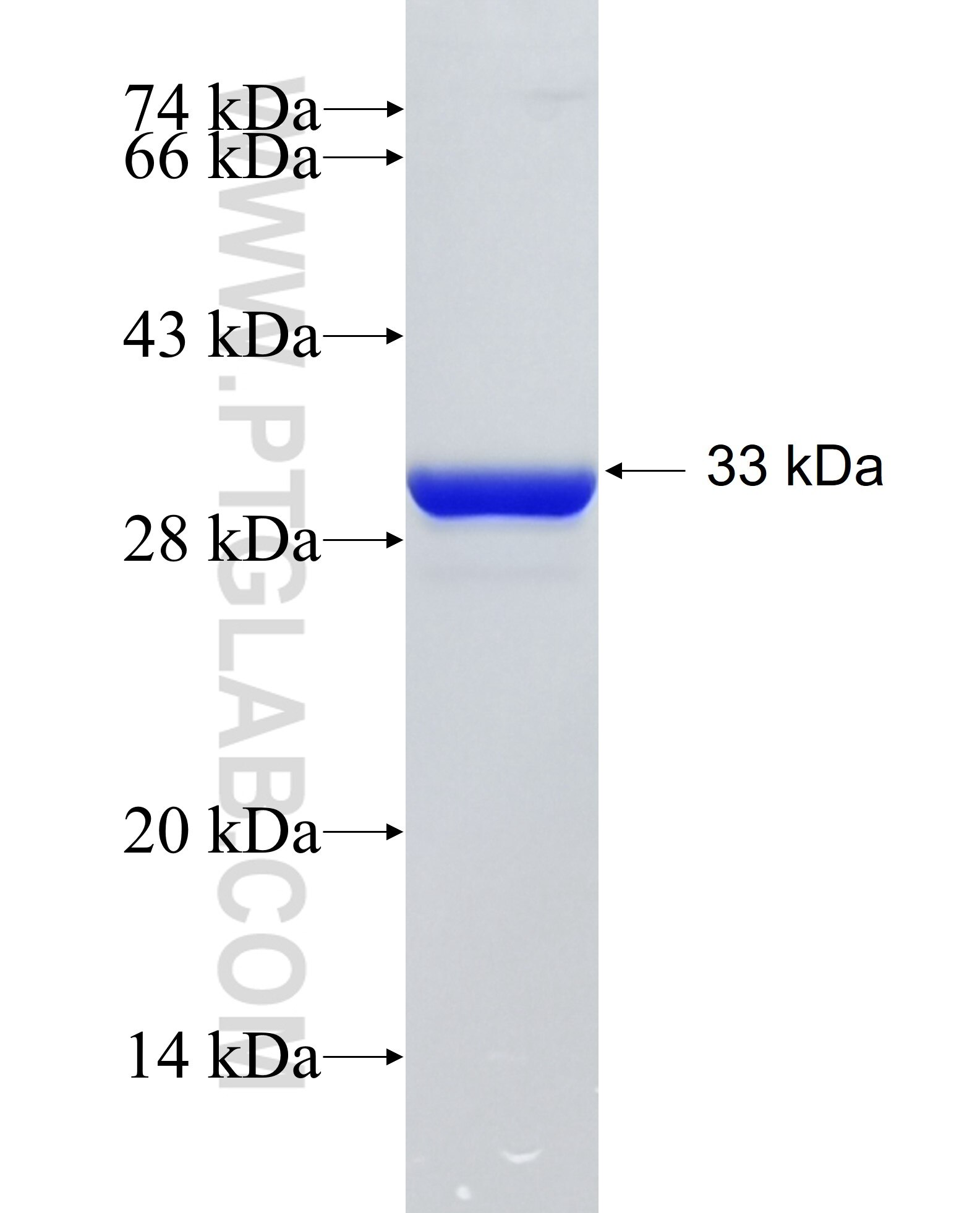 CDKN2B fusion protein Ag26955 SDS-PAGE