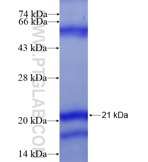 CDKN2B fusion protein Ag16059 SDS-PAGE