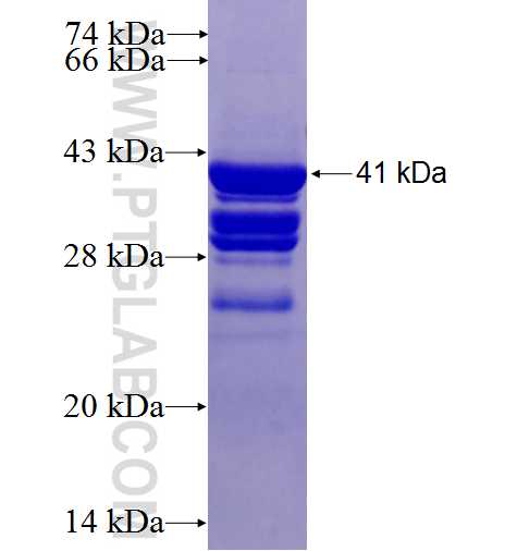 CDKN2B fusion protein Ag3557 SDS-PAGE