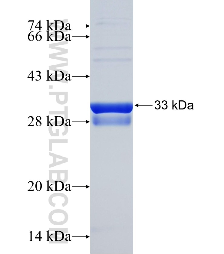 CDKN2C fusion protein Ag25438 SDS-PAGE