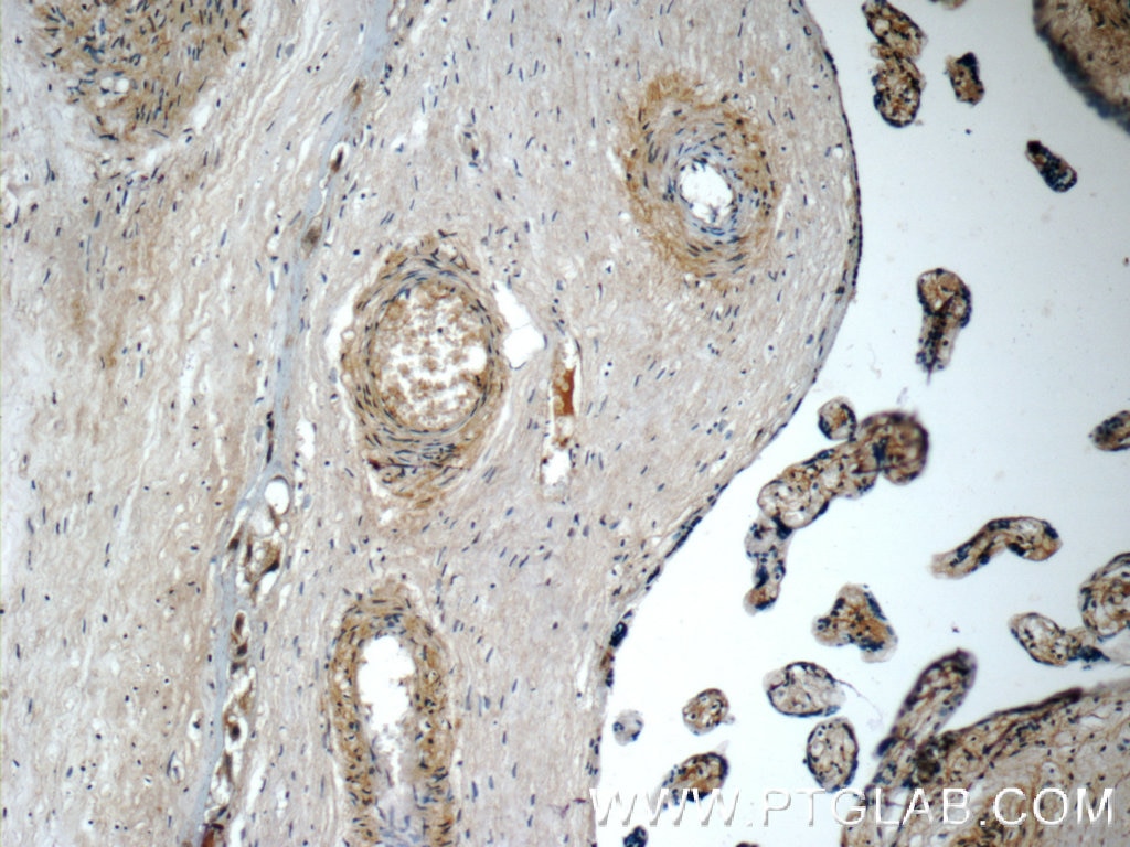 Immunohistochemistry (IHC) staining of human placenta tissue using CDO1 Polyclonal antibody (12589-1-AP)