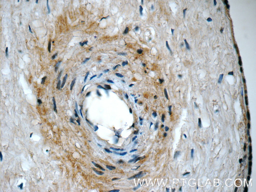 Immunohistochemistry (IHC) staining of human placenta tissue using CDO1 Polyclonal antibody (12589-1-AP)