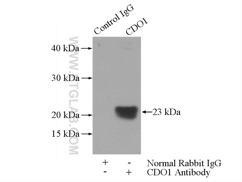 Immunoprecipitation (IP) experiment of mouse liver tissue using CDO1 Polyclonal antibody (12589-1-AP)