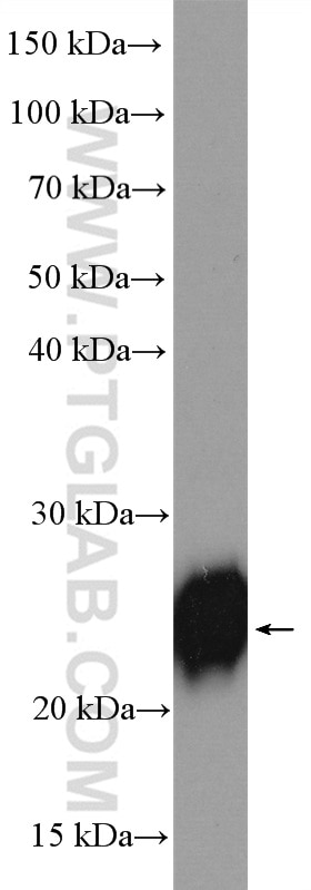 Western Blot (WB) analysis of rat liver tissue using CDO1 Polyclonal antibody (12589-1-AP)