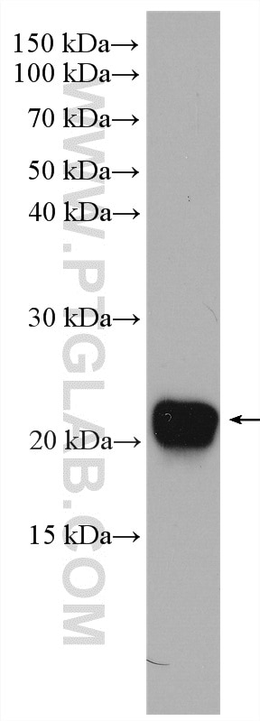 Western Blot (WB) analysis of mouse liver tissue using CDO1 Polyclonal antibody (12589-1-AP)