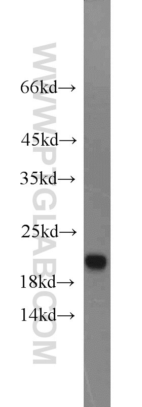 Western Blot (WB) analysis of mouse liver tissue using CDO1 Polyclonal antibody (12589-1-AP)