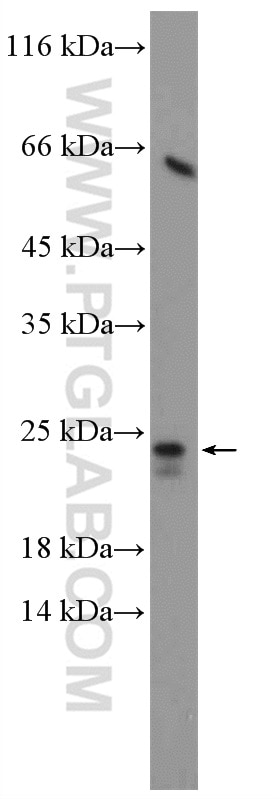 Western Blot (WB) analysis of rat liver tissue using CDO1 Polyclonal antibody (12589-1-AP)