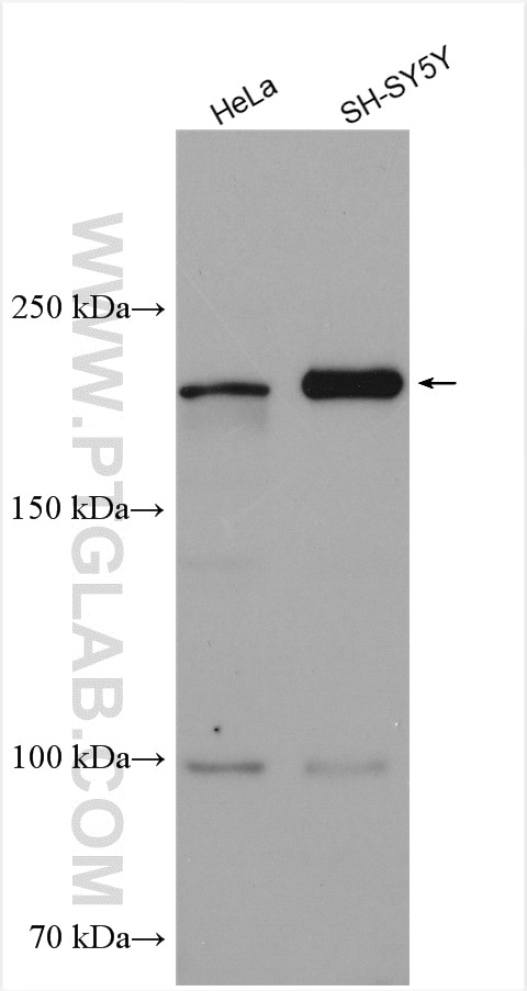 Western Blot (WB) analysis of various lysates using CDON Polyclonal antibody (17634-1-AP)