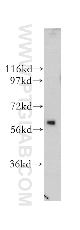 Western Blot (WB) analysis of human brain tissue using CDR2 Polyclonal antibody (11611-2-AP)