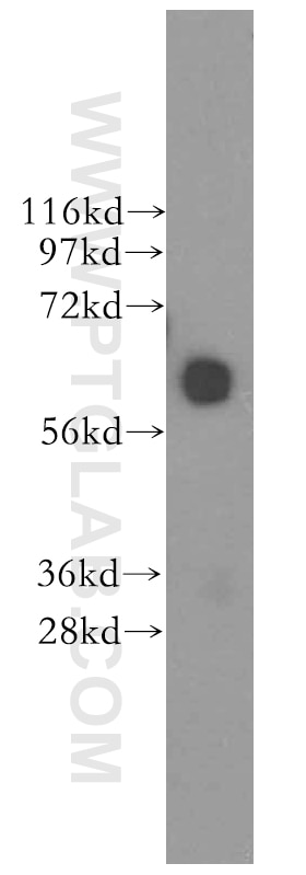 Western Blot (WB) analysis of human brain tissue using CDR2 Polyclonal antibody (11611-2-AP)