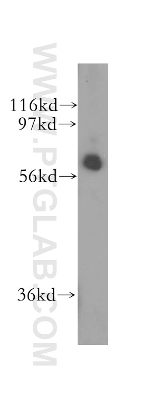 Western Blot (WB) analysis of Y79 cells using CDR2 Polyclonal antibody (11611-2-AP)