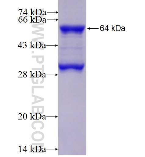 CDR2 fusion protein Ag2183 SDS-PAGE