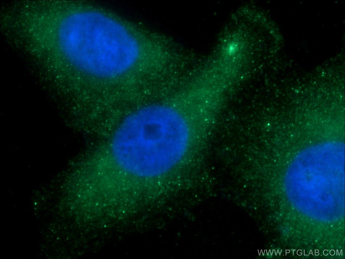 Immunofluorescence (IF) / fluorescent staining of HepG2 cells using CDR2L Polyclonal antibody (14563-1-AP)