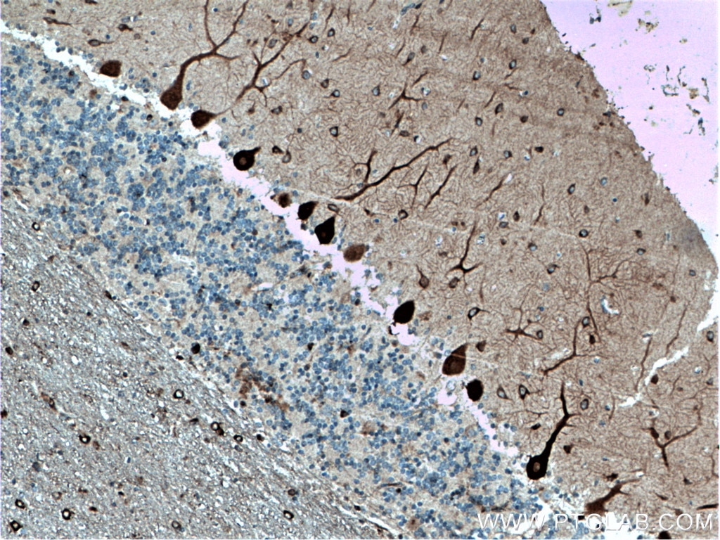 Immunohistochemistry (IHC) staining of human cerebellum tissue using CDR2L Polyclonal antibody (14563-1-AP)