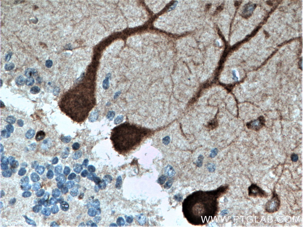 IHC staining of human cerebellum using 14563-1-AP