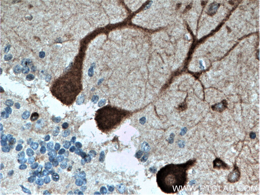 Immunohistochemistry (IHC) staining of human cerebellum tissue using CDR2L Polyclonal antibody (14563-1-AP)