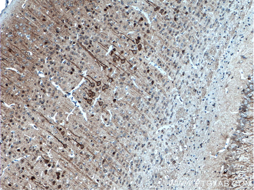 Immunohistochemistry (IHC) staining of mouse brain tissue using CDR2L Polyclonal antibody (14563-1-AP)