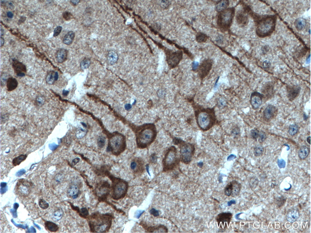 Immunohistochemistry (IHC) staining of mouse brain tissue using CDR2L Polyclonal antibody (14563-1-AP)