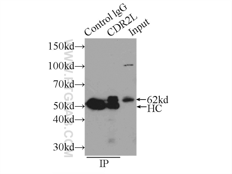Immunoprecipitation (IP) experiment of SH-SY5Y cells using CDR2L Polyclonal antibody (14563-1-AP)