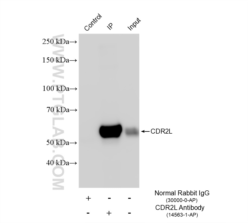 Immunoprecipitation (IP) experiment of SH-SY5Y cells using CDR2L Polyclonal antibody (14563-1-AP)