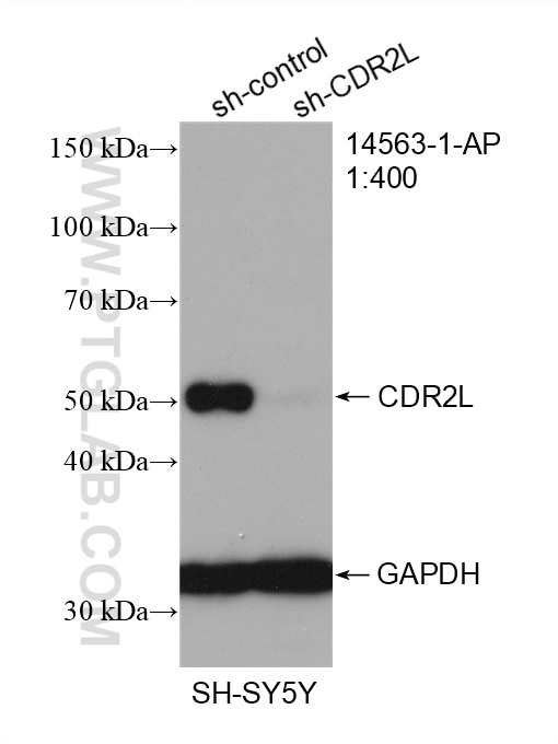 Western Blot (WB) analysis of SH-SY5Y cells using CDR2L Polyclonal antibody (14563-1-AP)